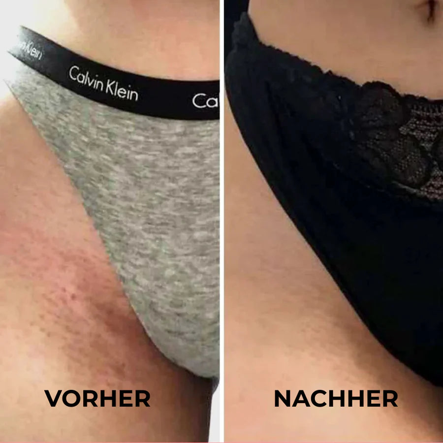SKINGLIDE™ – Für Haut, die sich wie Seide anfühlt - Sag Tschüss zu Rasierpickeln, Stoppeln & Hautstress