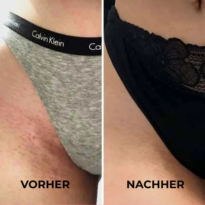SKINGLIDE™ – Für Haut, die sich wie Seide anfühlt - Sag Tschüss zu Rasierpickeln, Stoppeln & Hautstress